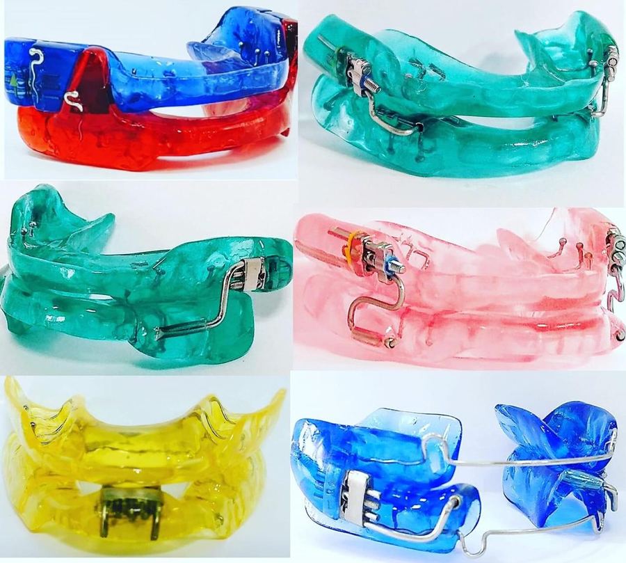 Aparelho intraoral para ronco e apneia do sono